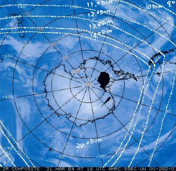 南極圏波動変換施術